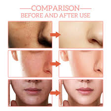 FORT 5IN1 Whitening Serum
